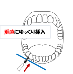 歯間ブラシ使い方イラスト